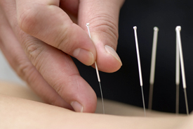 acupuncture practitioner algarve