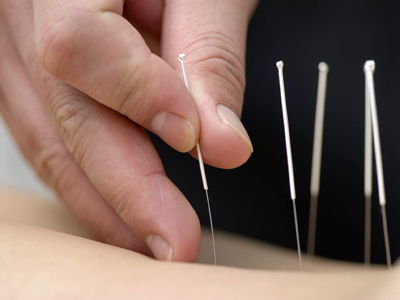 acupuncture algarve